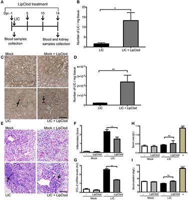 Macrophages and Galectin 3 Control Bacterial Burden in Acute and Subacute Murine Leptospirosis That Determines Chronic <mark class="highlighted">Kidney Fibrosis</mark>